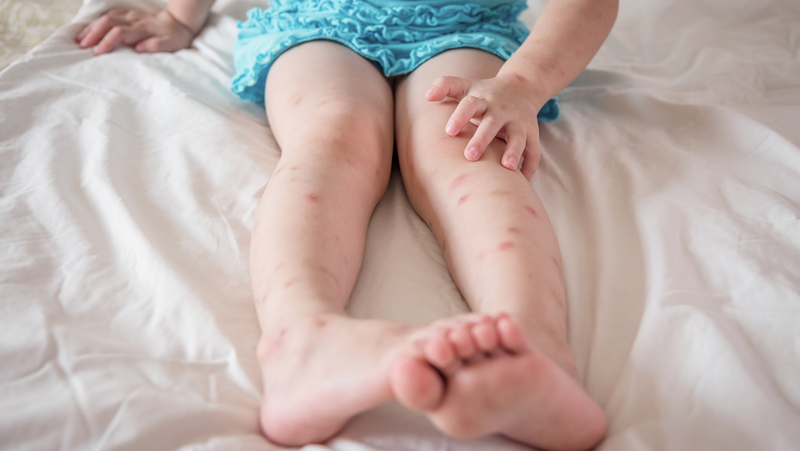 Summer is here but so are the mozzies - Why they love us and how to keep them away